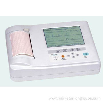 ECG Monitor